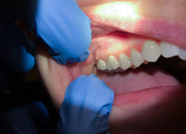 Best Emergency Dental Services for Seniors in Clinton, MD
