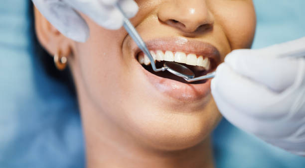 Best Emergency Dentist for Special Needs Patients in Clinton, MD