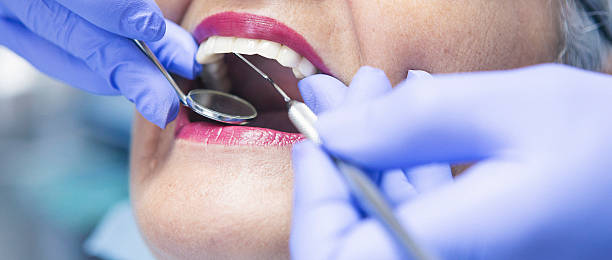 Best Emergency Dentist for Knocked-Out Tooth in Clinton, MD
